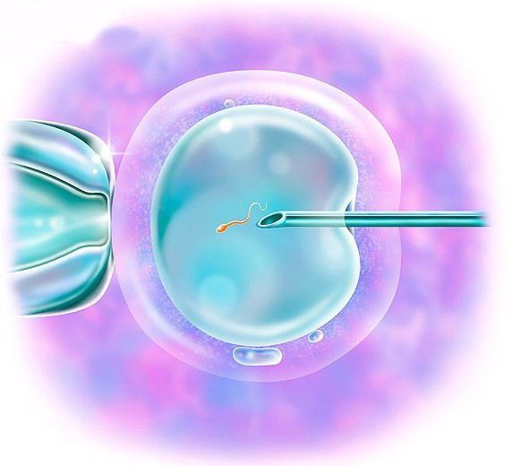 岳阳借卵-amh0.42，6次疫苗接种和3次移植，我只能寄希望于最后一个胚胎。