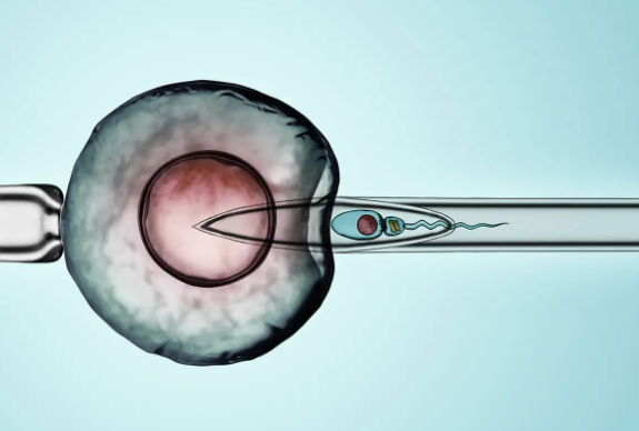 株洲合法供卵生子流程-试管婴儿囊胚移植的成功率高吗？试管婴儿三期的过程是痛苦的吗？